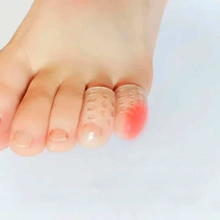 La protezione è realizzata in silicone premium di grado medico, privo di lattice!